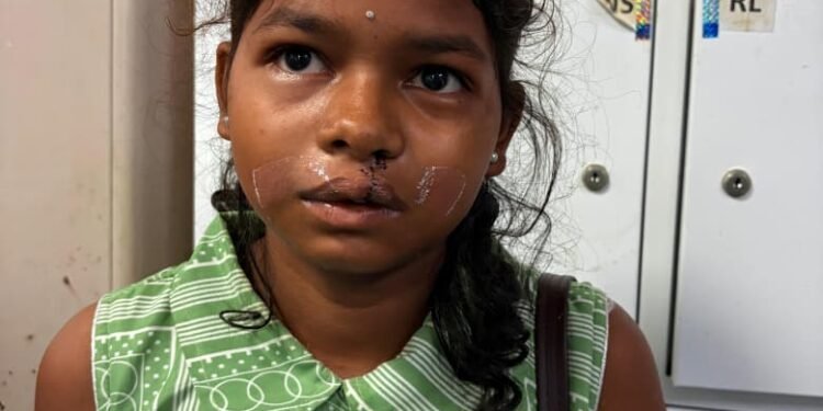 From a cleft lip to a broken spirit… one operation and life changed