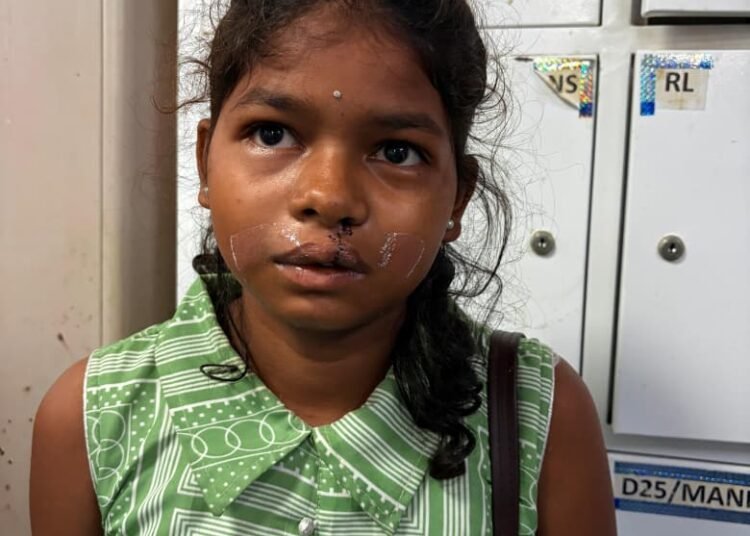 From a cleft lip to a broken spirit… one operation and life changed